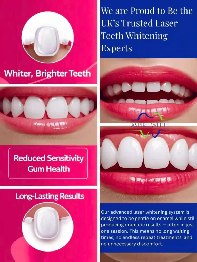 We are Proud to Be the UK’s Trusted Laser Teeth Whitening Experts Peterborough