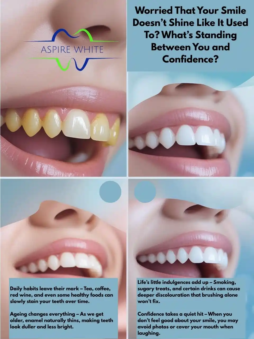 Worried That Your Smile Doesn’t Shine Like It Used To What’s Standing Between You and Confidence Peterborough